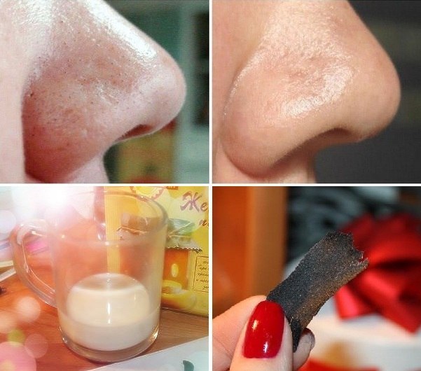 máscaras simples para remover cravos no nariz | Dicas de Saúde máscaras simples para remover cravos no nariz