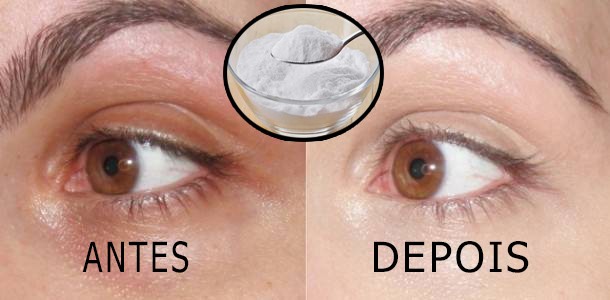 Acabe Com as Olheiras Rapidamente com Este Ingredientes | Dicas de Saúde Acabe Com as Olheiras Rapidamente com Este Ingredientes