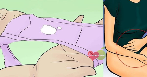 Causas do Corrimento Vaginal Branco Causas do Corrimento Vaginal Branco