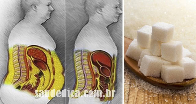 eliminar o alto teor de açúcar do seu corpo e perder peso | Dicas de Saúde eliminar o alto teor de açúcar do seu corpo e perder peso