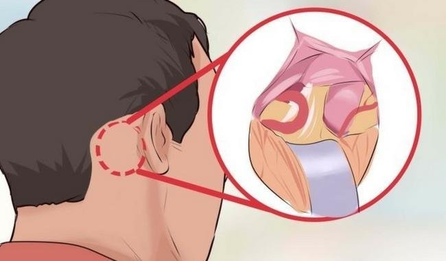Neuralgia do Trigêmeo | Dicas de Saúde