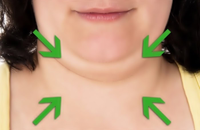 Dicas Para Reduzir a Papada