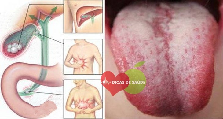 cheio de toxinas | Dicas de Saúde