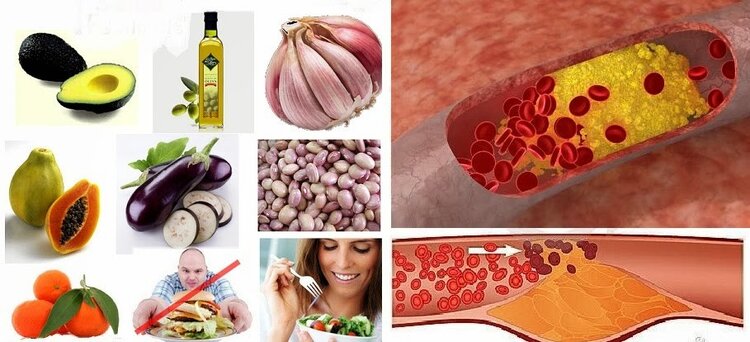 Dicas Para Reduzir o Níveis de Triglicerídeos Elevado | Dicas de Saúde Dicas Para Reduzir o Níveis de Triglicerídeos Elevado