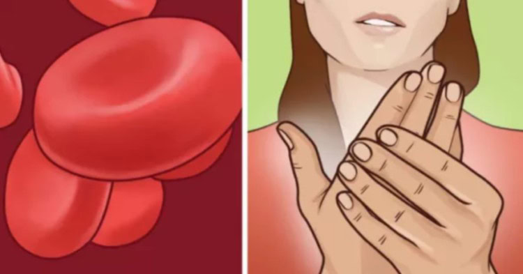 remédios caseiros para tratar a anemia | Dicas de Saúde remédios caseiros para tratar a anemia