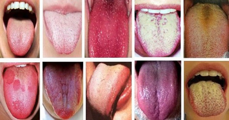 Avisos que a Língua Envia que Não Devem Ser Ignorados Avisos que a Língua Envia que Não Devem Ser Ignorados