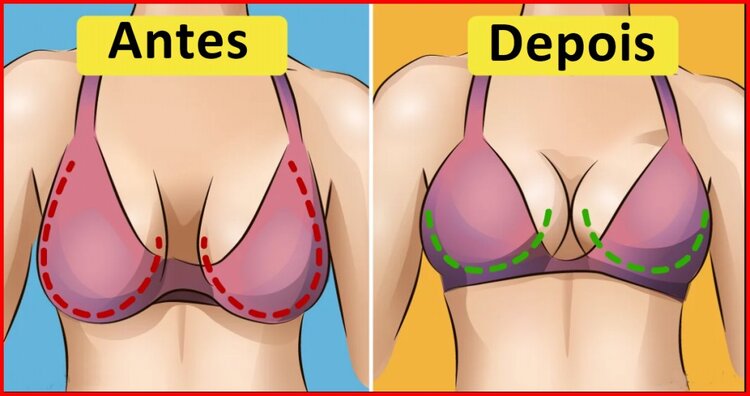 dicas para evitar a flacidez e queda dos seios dicas para evitar a flacidez e queda dos seios