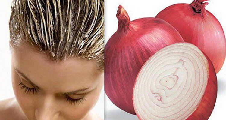 As 4 Maneiras de Turbinar o Crescimento do Cabelo com Cebola | Dicas de Saúde
