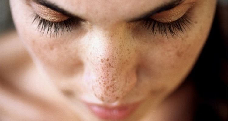 Remedio Caseiros Para Eliminar Manchas do Rosto | Dicas de Saúde