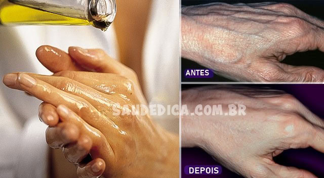 cremes caseiros para rejuvenescer as maos e eliminar rugas | Dicas de Saúde cremes caseiros para rejuvenescer as maos e eliminar rugas