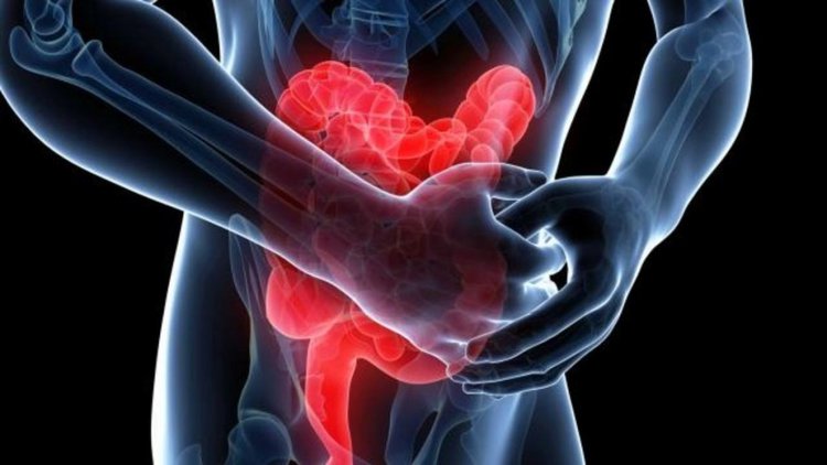 Como Tratar a Síndrome do Intestino Irritável Naturalmente 2 | Dicas de Saúde