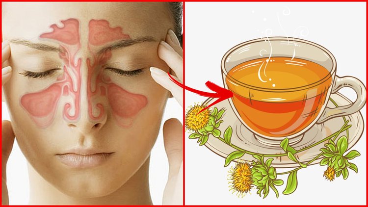 sinusite remedios caseiros | Dicas de Saúde