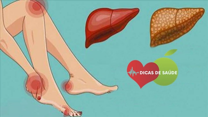 Fígado está Sobrecarregado | Dicas de Saúde Fígado está Sobrecarregado