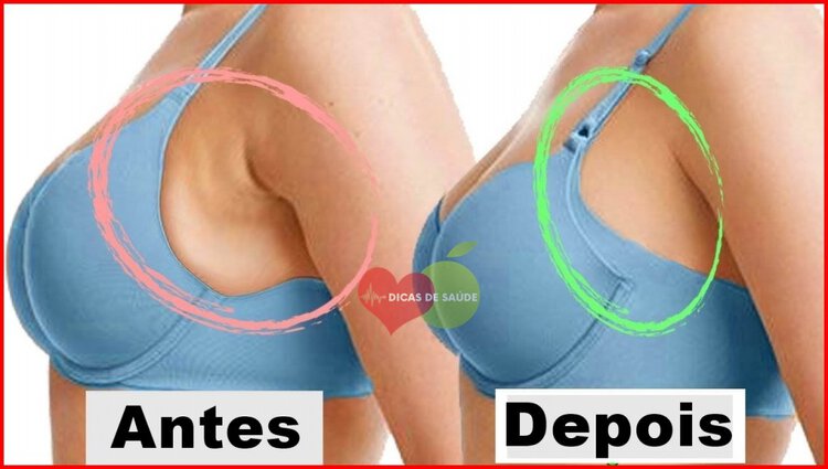 dicas para eliminar a gordura sob as axilas naturalmente | Dicas de Saúde dicas para eliminar a gordura sob as axilas naturalmente