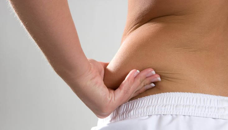 culotes-1 | Dicas de Saúde Exercício Para Eliminar os Culotes