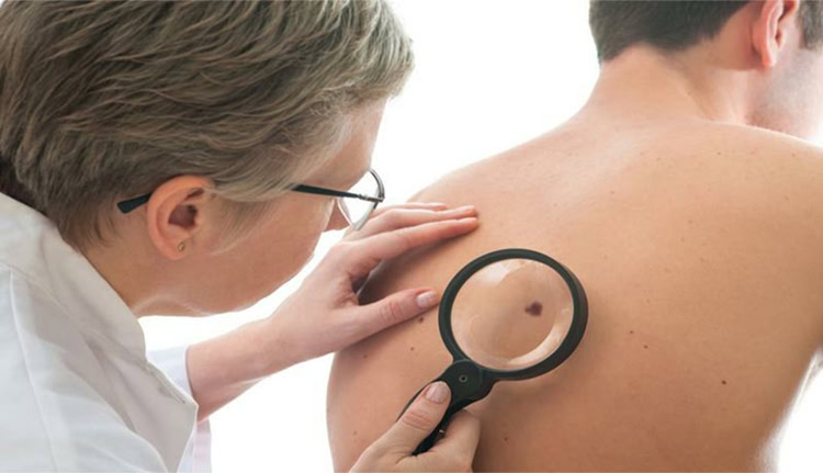 Lipossarcoma1 | Dicas de Saúde