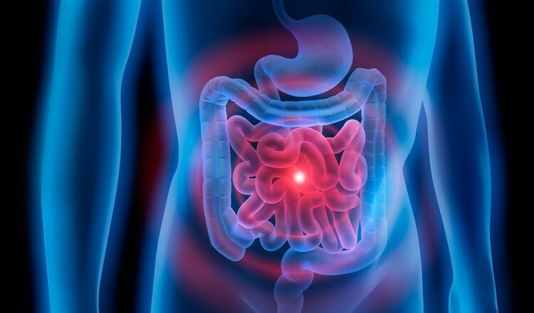 Como Tratar a Síndrome do Intestino Irritável Naturalmente 1 | Dicas de Saúde
