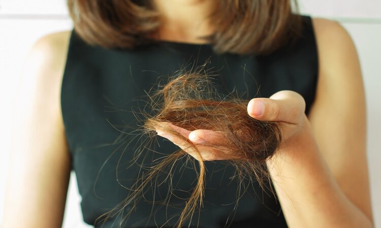perda de cabelo sintoma de problemas na tireoide | Dicas de Saúde perda de cabelo sintoma de problemas na tireoide
