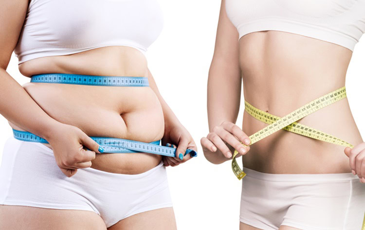 Woman's body before and after weight loss. | Dicas de Saúde