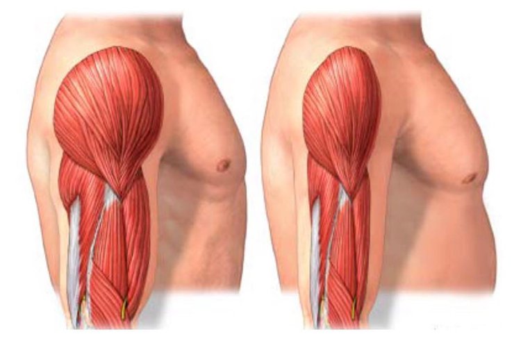 As 8 Principais Causas da Atrofia Muscular! As 8 Principais Causas da Atrofia Muscular!