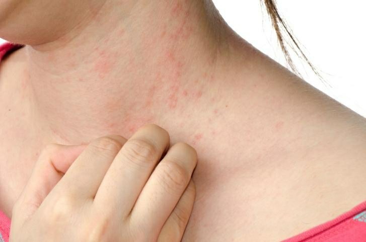 coceiras pelo corpo | Dicas de Saúde