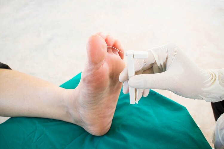 Neuropatia Sensorial Causas, Sintomas e Tratamentos 1 | Dicas de Saúde