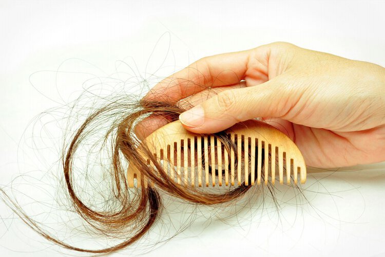 Reverter a Perda de Cabelo-2 | Dicas de Saúde