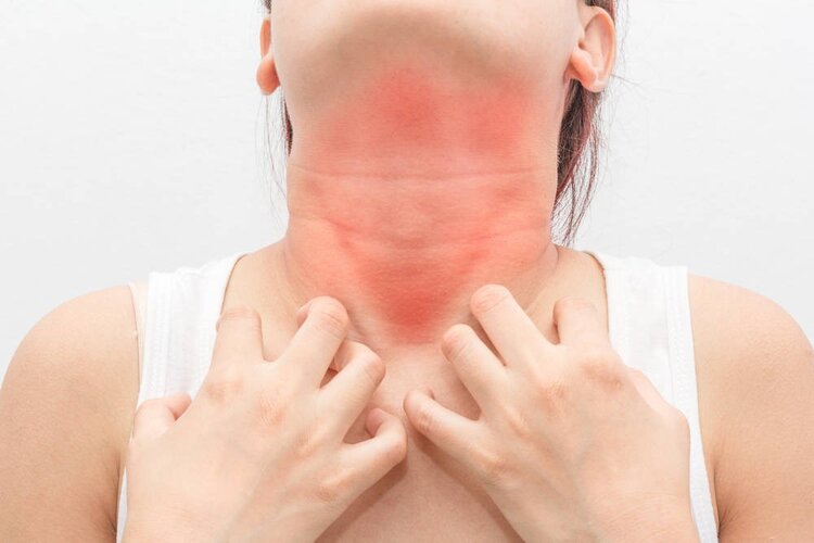 Chá de Canela Para Inflamação na Garganta Chá de Canela Para Inflamação na Garganta