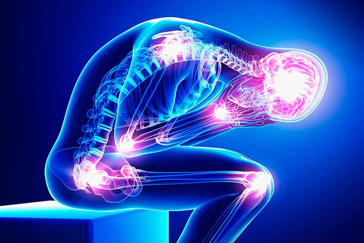 Fibromialgia juvenil | Dicas de Saúde