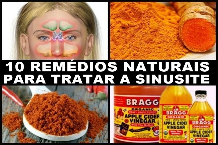 tratar a sinusite | Dicas de Saúde