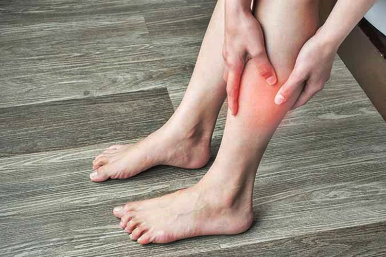 sinais de que você tem um coágulo na perna | Dicas de Saúde sinais de que você tem um coágulo na perna