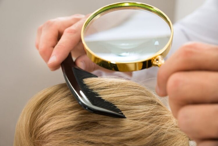 consulte um dermatologista para tratar a caspa | Dicas de Saúde consulte um dermatologista para tratar a caspa