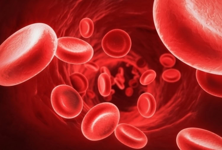 Anemia Megaloblástica Anemia Megaloblástica