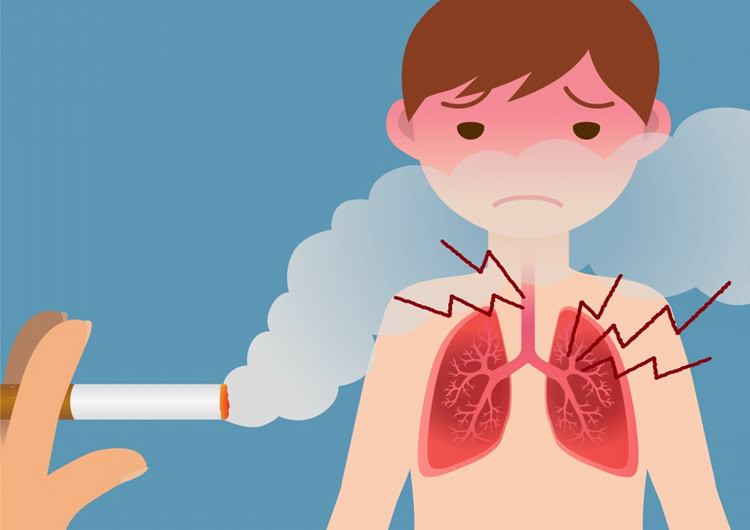 enfisema pulmonar | Dicas de Saúde
