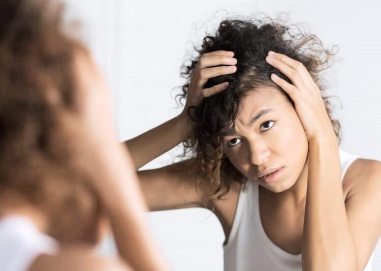 caspa no cabelo | Dicas de Saúde caspa no cabelo