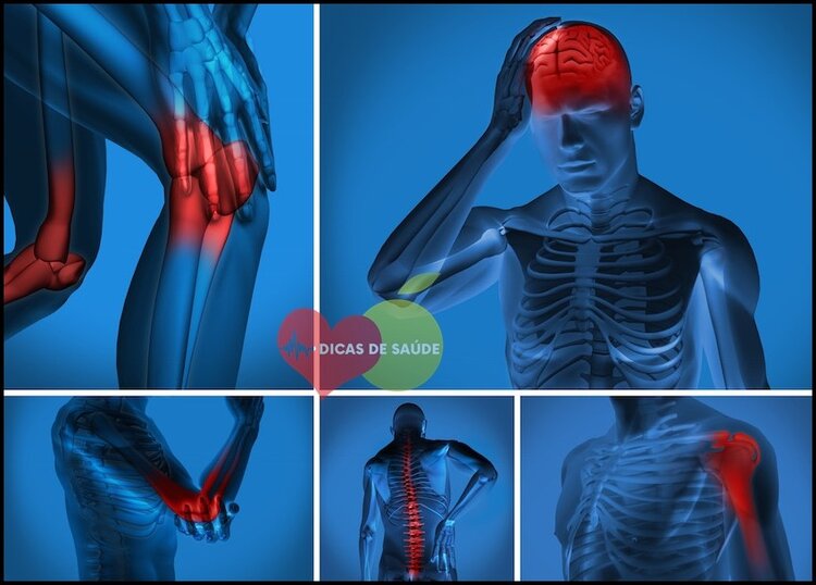 Dores Musculares Dores Musculares