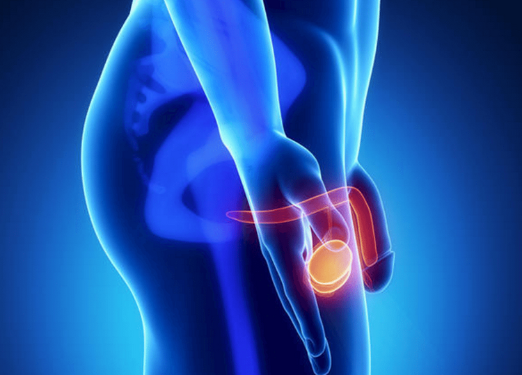 Câncer Testicular-3 | Dicas de Saúde