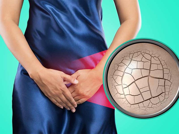 ressecamento vaginal | Dicas de Saúde ressecamento vaginal