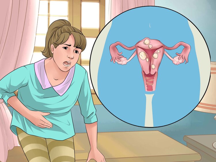 menstruação irregular | Dicas de Saúde