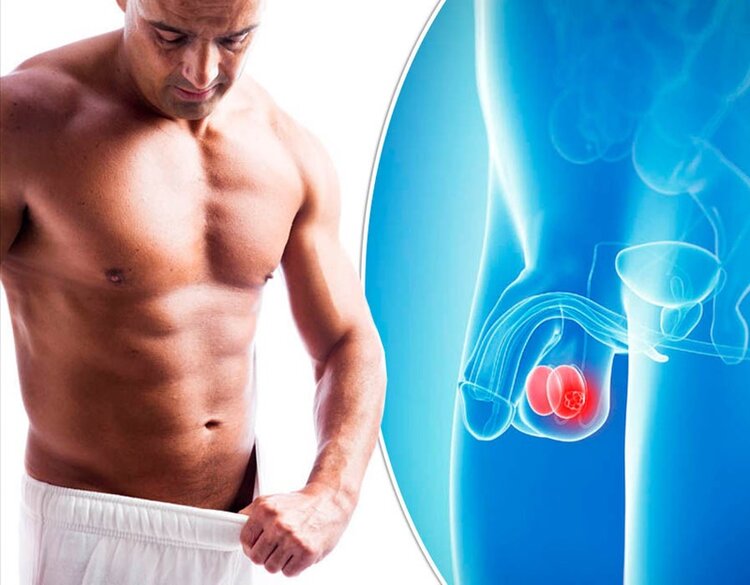 Câncer testicular-1 | Dicas de Saúde Câncer Testicular