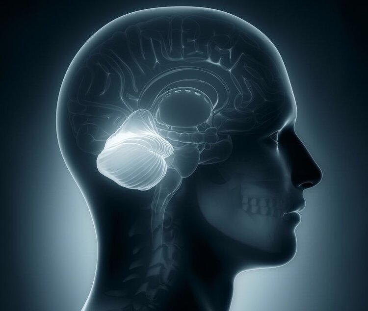Ataxia Cerebelar Aguda | Dicas de Saúde
