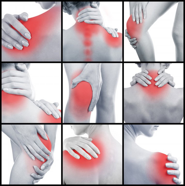 fibromialgia-2 | Dicas de Saúde fibromialgia-2