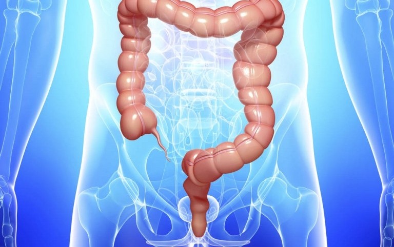 inflamaçao do colon | Dicas de Saúde inflamaçao do colon