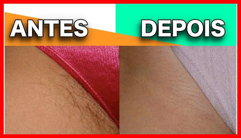 dicas para fazer depilaçao da virilha com cera | Dicas de Saúde dicas para fazer depilaçao da virilha com cera