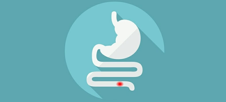 cancer-de-colon-6 | Dicas de Saúde