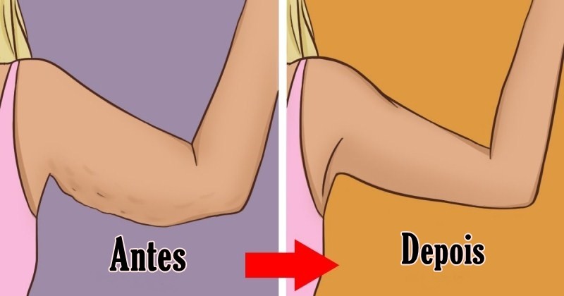 Diga Adeus a Pele Flácida Com Estes 5 Eficazes Remédios Caseiros 1 | Dicas de Saúde
