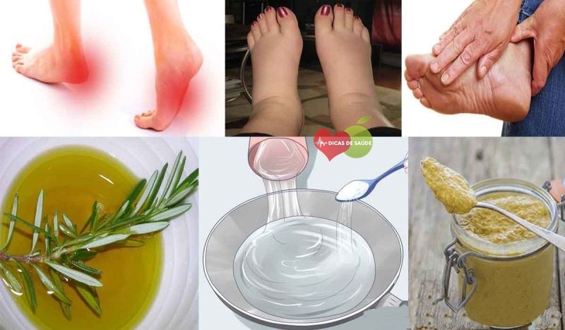 Solução Natural e Definitiva Para Dor e Inchaço nos Pés | Dicas de Saúde