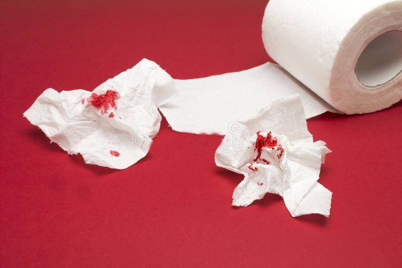principais causas de sangue nas fezes | Dicas de Saúde principais causas de sangue nas fezes