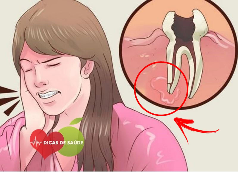 Elimine a Dor de Dente Imediatamente com Esta Receita Caseira | Dicas de Saúde