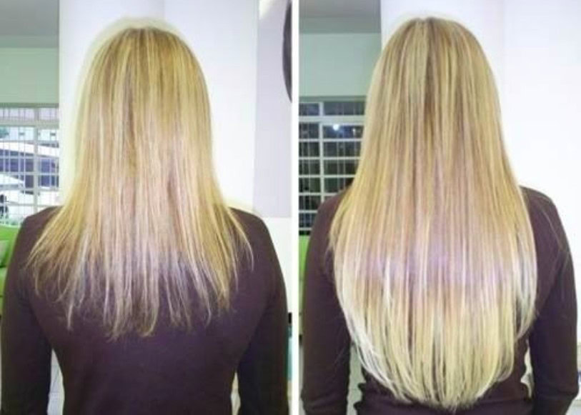 Os 5 Alimentos Ricos em Vitamina B que Ajudam no Crescimento do Cabelo | Dicas de Saúde